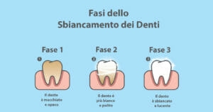 Dentifricio sbiancante infografica