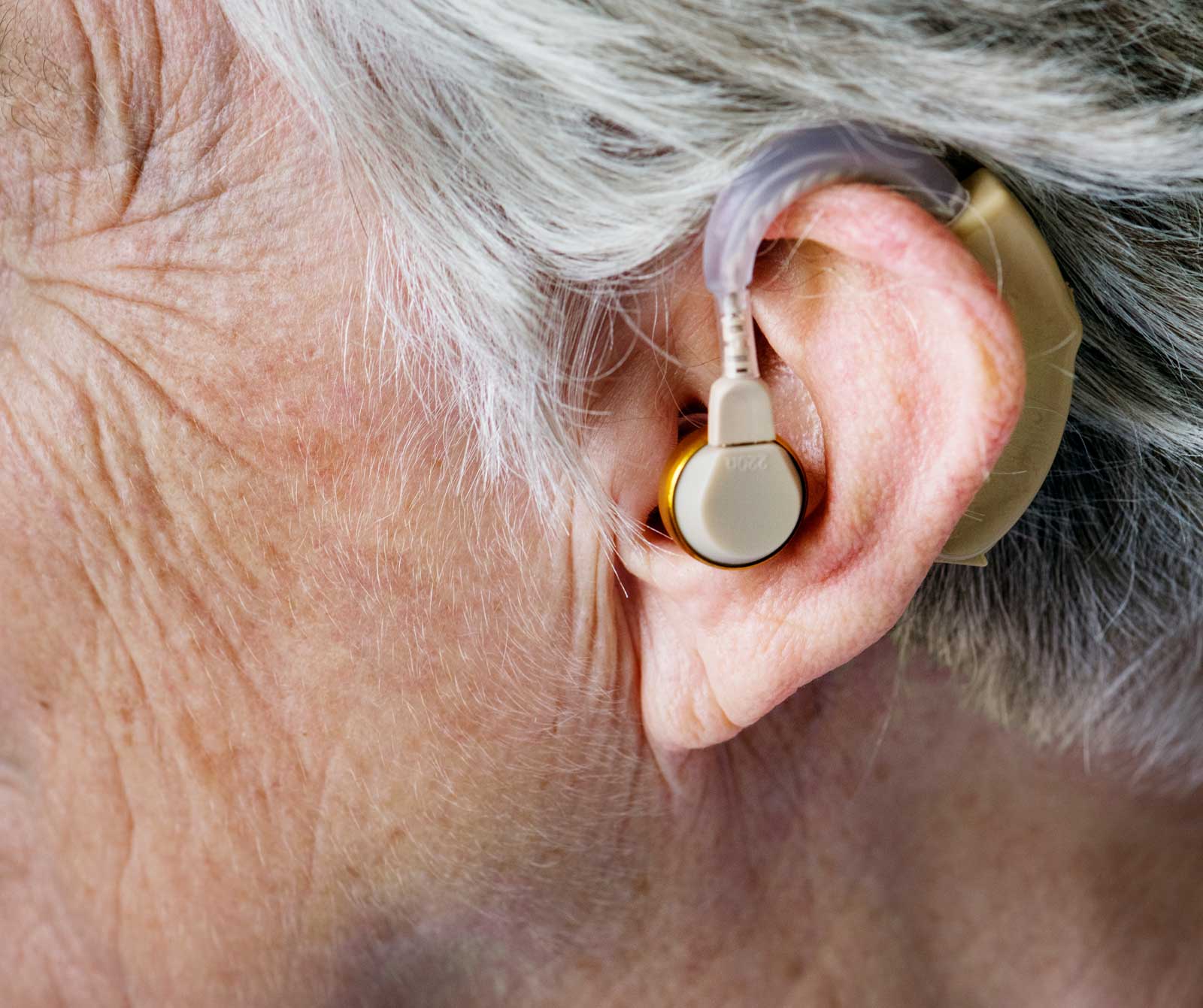 Apparecchi acustici Microear per sordi amplificatori acustici digitali Bte  ricaricabili Amplificatore sonoro per sordità Cuffie per sordità di alta  qualità